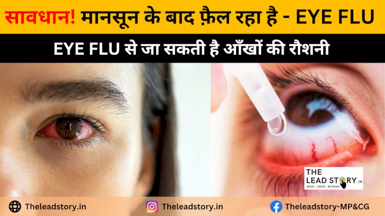 Eye Flu NEWS: ​आई फ्लू से लाल हो रही आंखे,